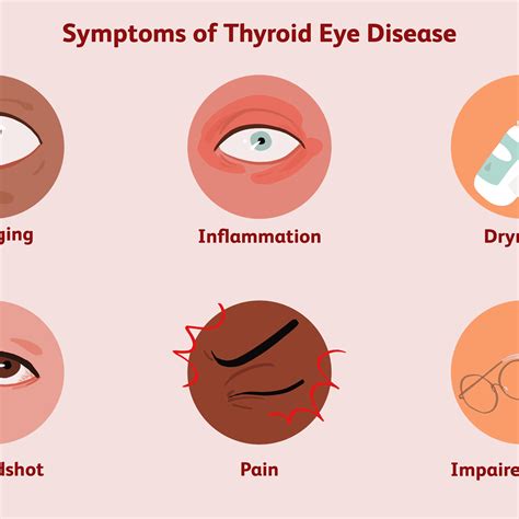 Underactive Thyroid Symptoms Eye Problems