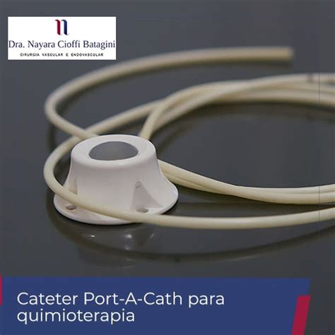 Cateter Port A Cath Para Quimioterapia Dra Nayara Cioffi Batagini
