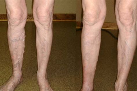 Luar Biasa !! Inilah 5 Cara Sederhana Ampuh Dan Tanpa ...