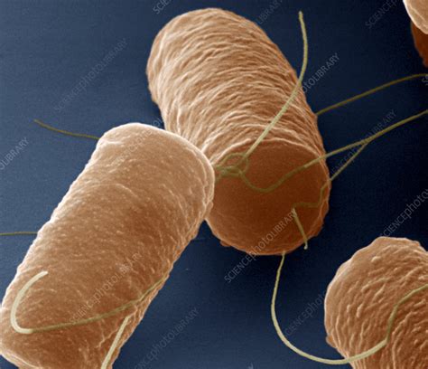 Bacillus Cereus Bacteria Sem Stock Image C0090419 Science Photo