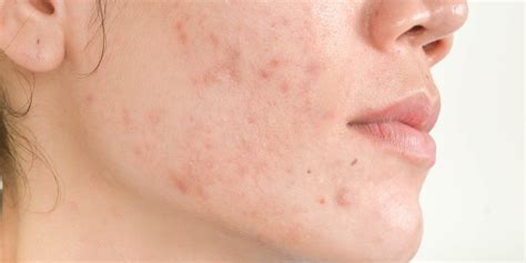 Entdecke rezepte, einrichtungsideen, stilinterpretationen und andere ideen zum ausprobieren. Pin on beauty