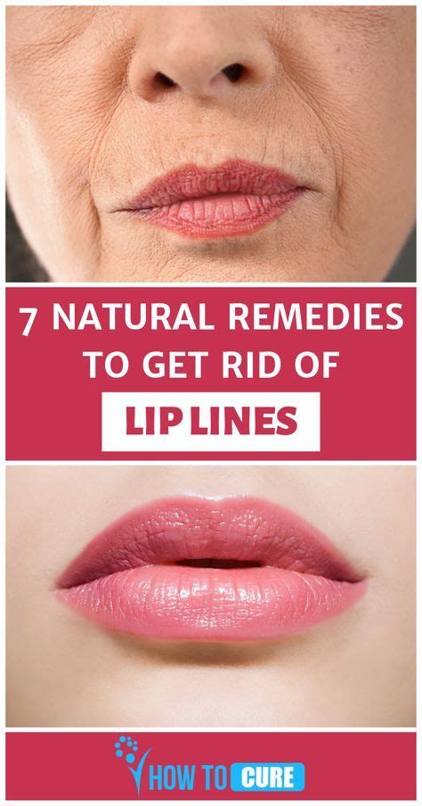 7 Inexpensive Remedies To Get Rid Of Lip Lines How To Line Lips Lip Wrinkles Natural Lips