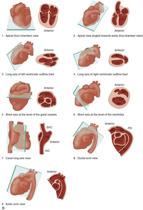 The Fetal Cardiovascular Examination Radiology Key