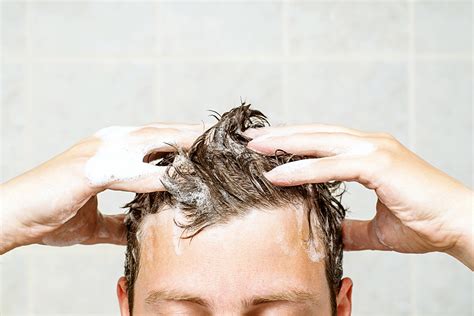 How Soon Can I Wash My Hair After Hair Transplant Surgery Utah