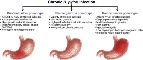 Host Bacterial Interactions In Helicobacter Pylori Infection