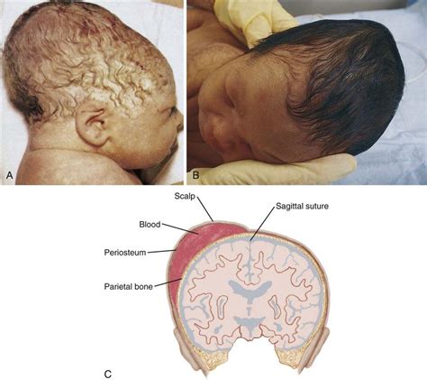 12 The Term Newborn Nurse Key