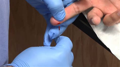 Dermal Puncture Capillary Blood Collection Procedure Youtube