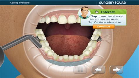 Virtual Braces By Clearly Trained