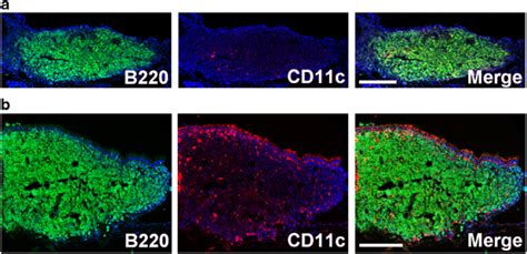 Nasopharynx Associated Lymphoid Tissue Nalt Dendritic Cells Dcs In