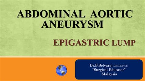 Abdominal Aortic Aneurysm Epigastric Lumps Abdominal Lumpspptx
