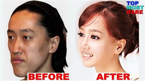 Chinese Actress Before And After Plastic Surgery