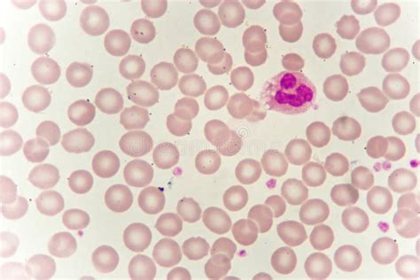 Monocyte Cell Stock Photo Image Of Leukocyte Microscopy 92593956