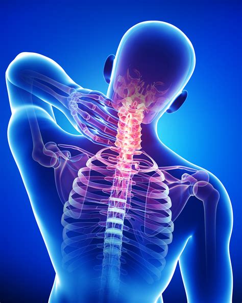 Neck Pain Back Of Neck Anatomy Treating Neck Pain Spreading To Your