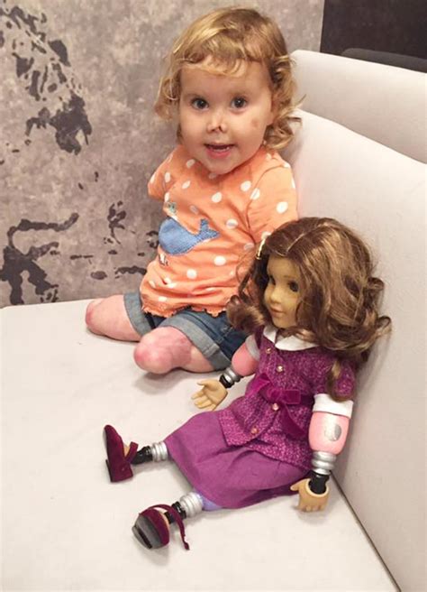 quadruple amputee 2 gets look alike american girl doll
