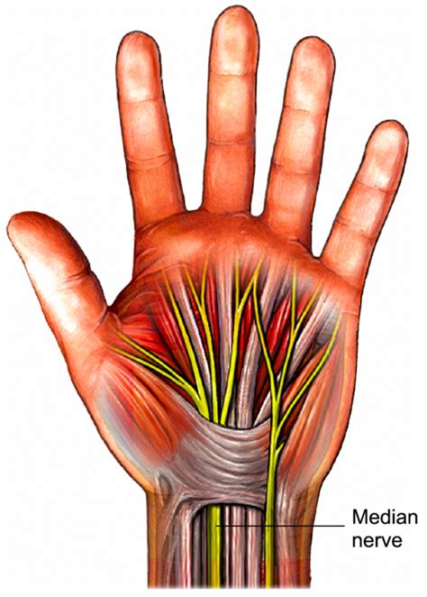 Carpal Tunnel Syndrome Fife Virtual Hand Clinic