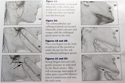 Reasonably Well Ssf Patient Education Sheet How To Massage Salivary
