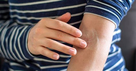 What Causes Dry White Patches On Skin Scripps Health