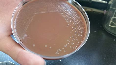 Neisseria Gonorrhoeae En Agar Chocolate Microbiología Microbiología