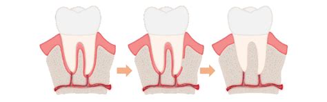 10 Most Common Orthodontic Problems Wilkinson Orthodontics Gold