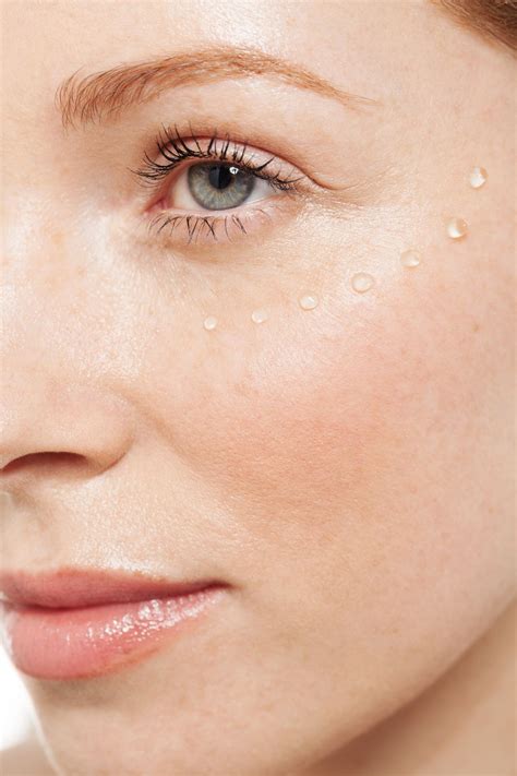 Dry Eyelids Causes And Remedies According To Dermatologists