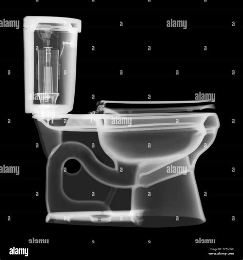 Toilet Side Profile X Ray Stock Photo Alamy