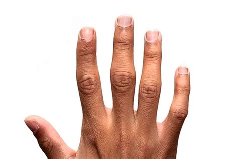 Long Finger Linked To Cancer Risk Study Finds Wsj