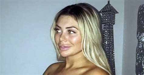 Chloe Ferry Strips Topless To Show Off New Nose And Boobs After Plastic Surgery Daily Star