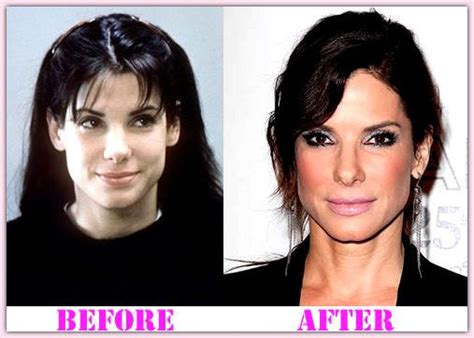 She is one of the hottest women in movies and on tv. Sandra Bullock Plastic Surgery Before And After Sandra ...