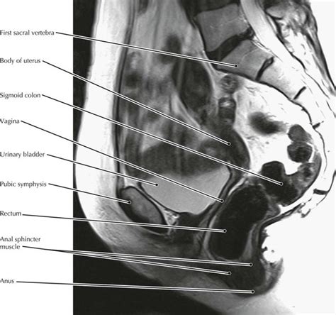 Pelvis and Perineum | Radiology Key