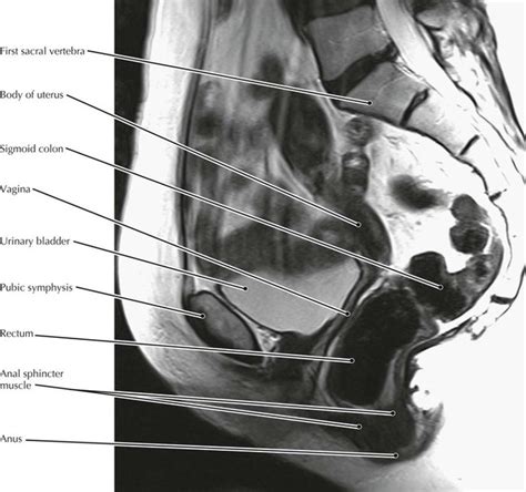 Pelvis And Perineum Radiology Key