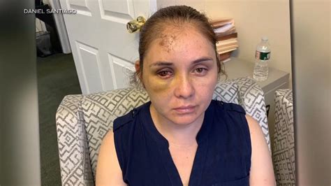 Mother Allegedly Attacked By Her Sons 13 Year Old Bully