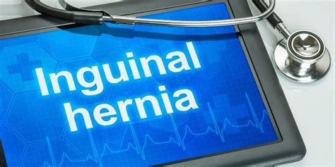 What Is The Best Type Of Inguinal Hernia Repair Rg Hospital