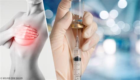 fulvestrant la segunda línea de tratamiento en el cáncer de mama mejor con salud