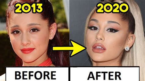Ariana Grandes Secret Plastic Surgery Transformation Before And After
