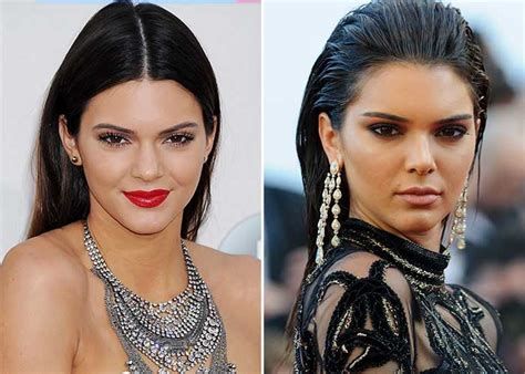 Kendall Jenner Plastic Surgery Nose Job Boob Job Lip Injection