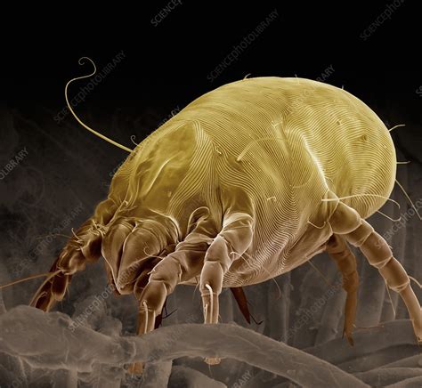 Dust Mite Sem Stock Image C0217273 Science Photo Library