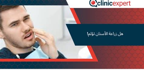 هل زراعة الأسنان تؤلم Clinicexpert خدمات زراعة الشعر والرعاية الصحية