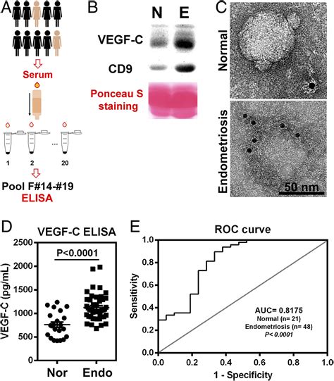 extracellular vesicle associated vegf c promotes lymphangiogenesis and immune cells infiltration