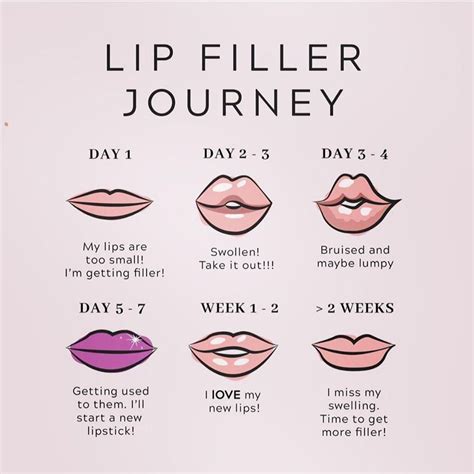 Lip Filler Swelling Day 2