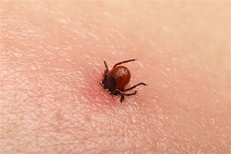 New Diseases Are Being Spread By Ticks