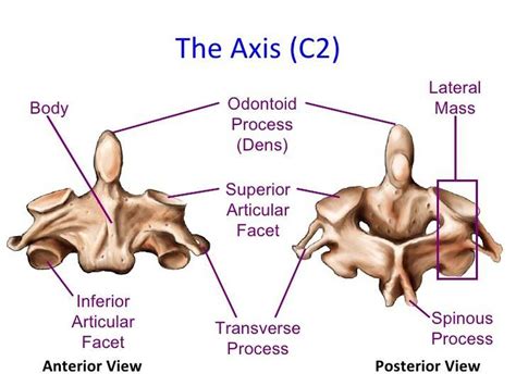 Pictures Of Axis Vertebra Odontoid Process