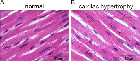 Cardiac Muscle Under Microscope 400x Labeled Micropedia