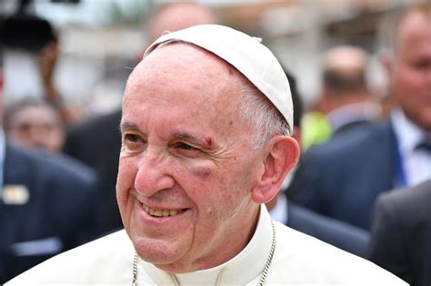 ˈxo̞ɾxe ˈmaɾjo β̞e̞ɾˈɣ̞oɣ̞ljo̞ (spanisch), [. Papst Franziskus: Blutiger Unfall in Kolumbien | GALA.de