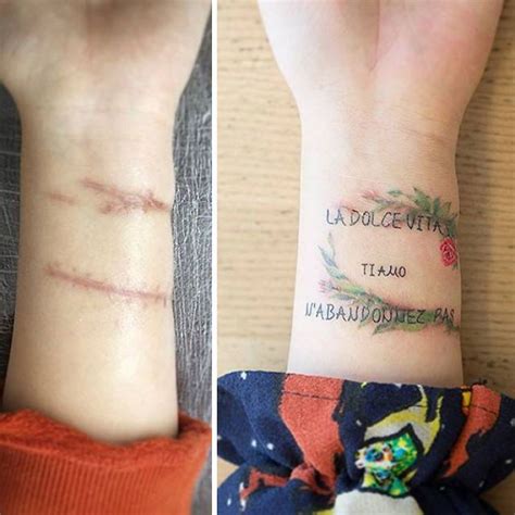 Lista 105 Foto Proceso De Cicatrización De Un Tatuaje Fotos Mirada Tensa