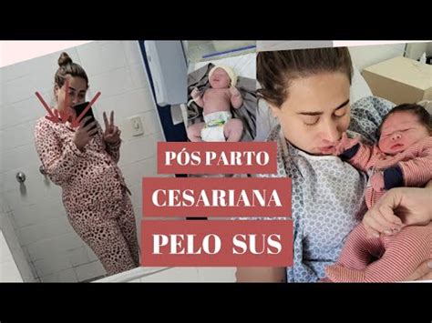Relato P S Parto Cesariana Pelo Sus Youtube
