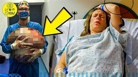 Woman Cant Give Birth Then Doctors Realize Whats Growing Inside Of