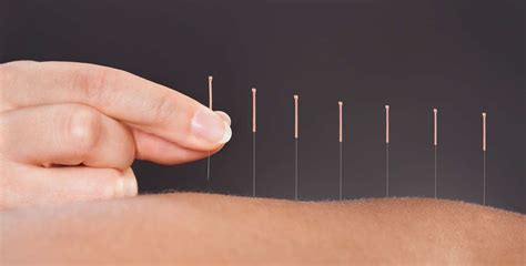 Akupunktur Dr Şükrü Bağcık