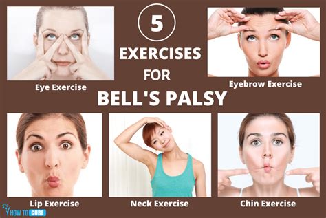 Bell's palsy can also interfere with the sense of taste. 5 Best Exercises For Bell's Palsy Treatment At Home | How ...