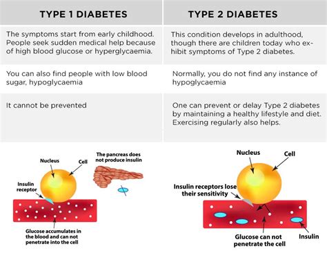 As someone with type 1 diabetes—i was diagnosed with it nearly 40 years ago—i'm all too familiar with the disease. Difference between Type 1 and Type 2 Diabetes and their ...