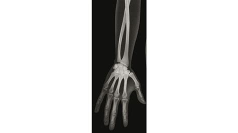 röntgenbilder mensch edumero de